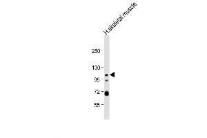 Western Blot at 1:1000 dilution + human skeletal muscle lysate Lysates/proteins at 20 ug per lane. (KCNQ5 抗体  (C-Term))