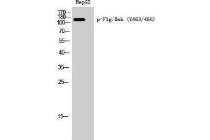 Western Blotting (WB) image for anti-FGFR1, FGFR2 (pTyr463), (pTyr466) antibody (ABIN3173105) (FGFR1/FGFR2 抗体  (pTyr463, pTyr466))