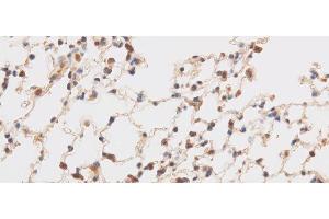Immunohistochemistry of paraffin-embedded Mouse brain using TRIP4 Polyclonal Antibody at dilution of 1:50 (TRIP4 抗体)