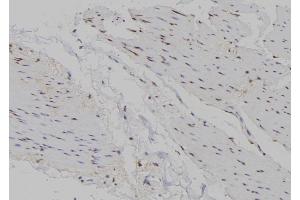 ABIN6266721 at 1/100 staining Human gastric tissue by IHC-P. (Musculin 抗体  (Internal Region))