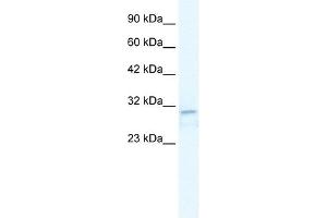 TRPM3 antibody used at 2. (TRPM3 抗体  (N-Term))