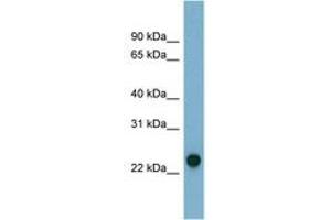Image no. 1 for anti-Adenylate Kinase 3 (AK3) (N-Term) antibody (ABIN6741718) (Adenylate Kinase 3 抗体  (N-Term))