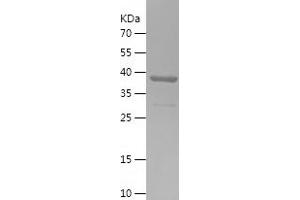 Western Blotting (WB) image for Transmembrane Emp24 Protein Transport Domain Containing 9 (TMED9) (AA 43-202) protein (His-IF2DI Tag) (ABIN7125476) (TMED9 Protein (AA 43-202) (His-IF2DI Tag))
