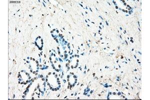 Immunohistochemical staining of paraffin-embedded Ovary tissue using anti-LTA4H mouse monoclonal antibody. (LTA4H 抗体)
