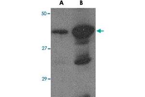 Western blot analysis of (A) 5 ng and (B) 25 ng of recombinant HA1 with Avian Influenza Hemagglutinin 2 polyclonal antibody  at 1 ug/mL . (Hemagglutinin 抗体  (N-Term))