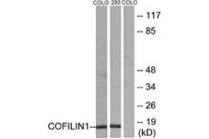 Western blot analysis of extracts from COLO205/293 cells, using Cofilin (Ab-3) Antibody. (Cofilin 抗体  (AA 1-50))