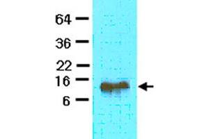 The extract of mouse heart (40 ug) was resolved by SDS-PAGE and probed with FABP4 monoclonal antibody, clone 3F4  (1:500). (FABP4 抗体  (AA 1-132))