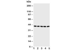 Western blot testing of BCAT2 antibody and Lane 1:  A431 (BCAT2 抗体  (C-Term))