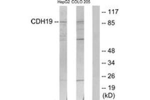 Western blot analysis of extracts from HepG2/COLO205 cells, using CDH19 Antibody. (CDH19 抗体  (AA 371-420))