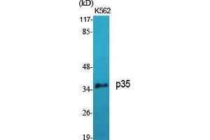Western Blot (WB) analysis of specific cells using p35 Polyclonal Antibody. (P35 (N-Term) 抗体)