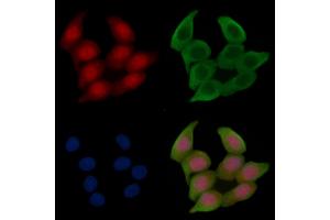 Phospho-HSP70 (Ser153) Antibody staining Hela cells(45 min of heat-shock treatment) by IF/ICC. (HSP70 抗体  (pSer153))
