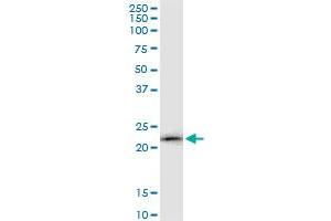 LCN2 MaxPab polyclonal antibody. (Lipocalin 2 抗体  (AA 1-198))