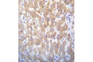 Formalin fixed and paraffin embedded human liver tissue reacted with FAST kinase (C-term) Antibody (C-term) Cat. (FASTK 抗体  (C-Term))