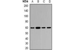 Western blot analysis of Tyrosyl-tRNA Synthetase expression in Hela (A), SKOV3 (B), mouse brain (C), rat brain (D) whole cell lysates. (YARS 抗体)