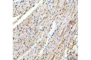 IHC analysis of TRIM63 using anti-TRIM63 antibody (ABIN3044380).