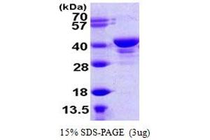 SDS-PAGE (SDS) image for Ubiquitin Carboxyl-terminal Hydrolase L5 (UCHL5) (AA 1-329) protein (His tag) (ABIN667457)