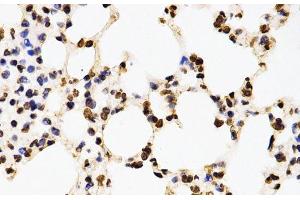 Immunohistochemistry of paraffin-embedded Mouse lung using Asymmetric DiMethyl-Histone H3-R17 Polyclonal Antibody at dilution of 1:200 (40x lens).