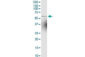 ZNF238 MaxPab rabbit polyclonal antibody. (ZNF238 抗体  (AA 1-522))