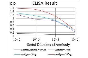 Black line: Control Antigen (100 ng), Purple line: Antigen(10 ng), Blue line: Antigen (50 ng), Red line: Antigen (100 ng), (CTNNBL1 抗体  (AA 390-557))