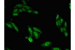 Immunofluorescent analysis of Hela cells using ABIN7152561 at dilution of 1:100 and Alexa Fluor 488-congugated AffiniPure Goat Anti-Rabbit IgG(H+L) (BRIP1 抗体  (AA 66-243))