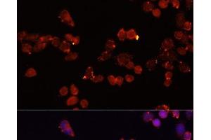 Immunofluorescence analysis of HeLa cells using SLC25A4 Polyclonal Antibody at dilution of 1:100 (40x lens). (SLC25A4 抗体)
