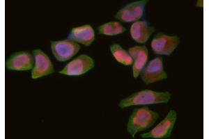 ABIN6266313 and ABIN6277430 staining Hela cells by IF/ICC. (RAD52 抗体  (Internal Region))