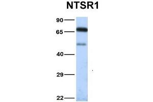 Host:  Rabbit  Target Name:  NTSR1  Sample Type:  Human Fetal Heart  Antibody Dilution:  1. (NTSR1 抗体  (N-Term))