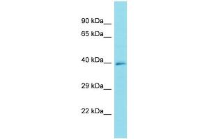 Host: Rabbit Target Name: FRMD6-AS1 Sample Type: U937 Whole Cell lysates Antibody Dilution: 1. (FRMD6-AS1 抗体  (C-Term))