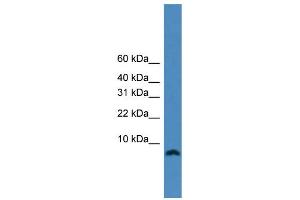 WB Suggested Anti-KIAA0101  Antibody Titration: 0. (KIAA0101 抗体  (N-Term))