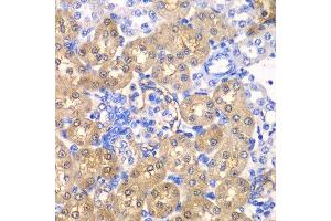 Immunohistochemistry of paraffin-embedded rat kidney using HPD antibody. (HPD 抗体  (AA 1-393))