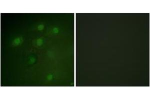 Immunofluorescence analysis of HeLa cells, using PDCD4 (Ab-457) Antibody. (PDCD4 抗体  (AA 420-469))