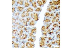 Immunohistochemistry of paraffin-embedded rat pancreas using CTRL Rabbit mAb (ABIN7266395) at dilution of 1:100 (40x lens). (Chymotrypsin 抗体)