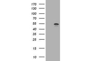 Image no. 1 for anti-Vimentin (VIM) antibody (ABIN1501722) (Vimentin 抗体)