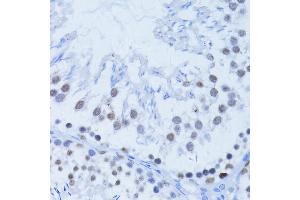Immunohistochemistry of paraffin-embedded rat testis using PARP1 Antibody (ABIN5975769) at dilution of 1/100 (40x lens). (PARP1 抗体)