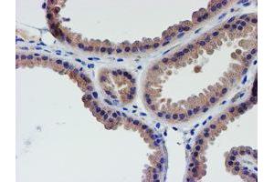 Immunohistochemical staining of paraffin-embedded Human breast tissue using anti-LECT2 mouse monoclonal antibody. (LECT2 抗体  (AA 19-151))