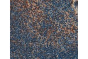 Used in DAB staining on fromalin fixed paraffin- embedded spleen tissue (SKAP1 抗体  (AA 1-355))