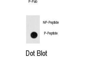 Dot blot analysis of anti-Phospho-ANTXR1-p Antibody (ABIN389930 and ABIN2839748) on nitrocellulose membrane. (ANTXR1 抗体  (pTyr382))