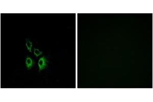 Immunofluorescence analysis of A549 cells, using ADRA1A Antibody. (alpha 1 Adrenergic Receptor 抗体  (AA 136-185))