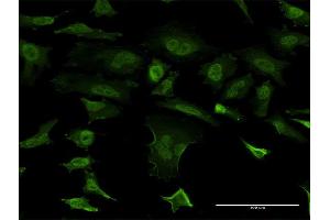 Immunofluorescence of monoclonal antibody to SNCB on HeLa cell. (beta Synuclein 抗体  (AA 1-134))