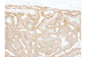 Immunohistochemistry (IHC) image for anti-Glucose-6-Phosphate Isomerase (GPI) (AA 508-558) antibody (ABIN7453918)