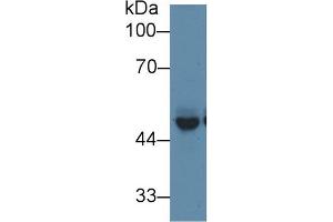 Western Blotting (WB) image for anti-Protein Interacting With Protein Kinase C, alpha 1 (PICK1) (AA 24-229) antibody (ABIN1860209)