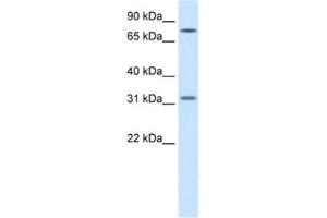 Western Blotting (WB) image for anti-Wingless-Type MMTV Integration Site Family, Member 8B (WNT8B) antibody (ABIN2460735)