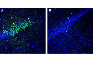 Expression of 5HT2C in mouse hippocampus. (HTR2C 抗体  (Extracellular))
