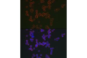 Immunofluorescence analysis of Raji cells using CD20 Rabbit pAb (ABIN7268473) at dilution of 1:150 (40x lens). (CD20 抗体  (AA 208-297))