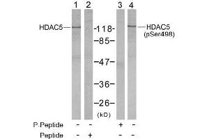 Image no. 2 for anti-Histone Deacetylase 5 (HDAC5) (pSer498) antibody (ABIN196932) (HDAC5 抗体  (pSer498))