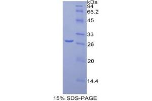 SDS-PAGE analysis of Mouse Orosomucoid 1 Protein. (ORM1 蛋白)