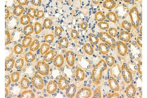 ABIN6260082 and ABIN6272540 at 1/100 staining Rat kidney tissue by IHC-P.