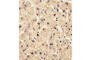 Antibody staining PGM1 in human liver tissue sections by Immunohistochemistry (IHC-P - paraformaldehyde-fixed, paraffin-embedded sections). (Phosphoglucomutase 1 抗体  (AA 251-282))