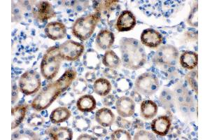 Anti-NOX1 antibody, HC(P) HC(P): Rat Kidney Tissue