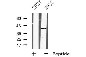 Western blot analysis of KLF12 expression in 293T whole cell lysate ,The lane on the left is treated with the antigen-specific peptide. (KLF12 抗体  (Internal Region))